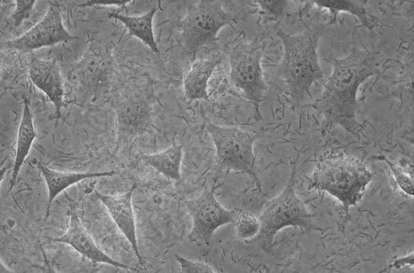 Zhonghong Boyuan teaches you how to correctly identify whether new cells are contaminated?