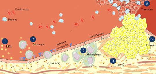 Small rodents: models of atherosclerosis