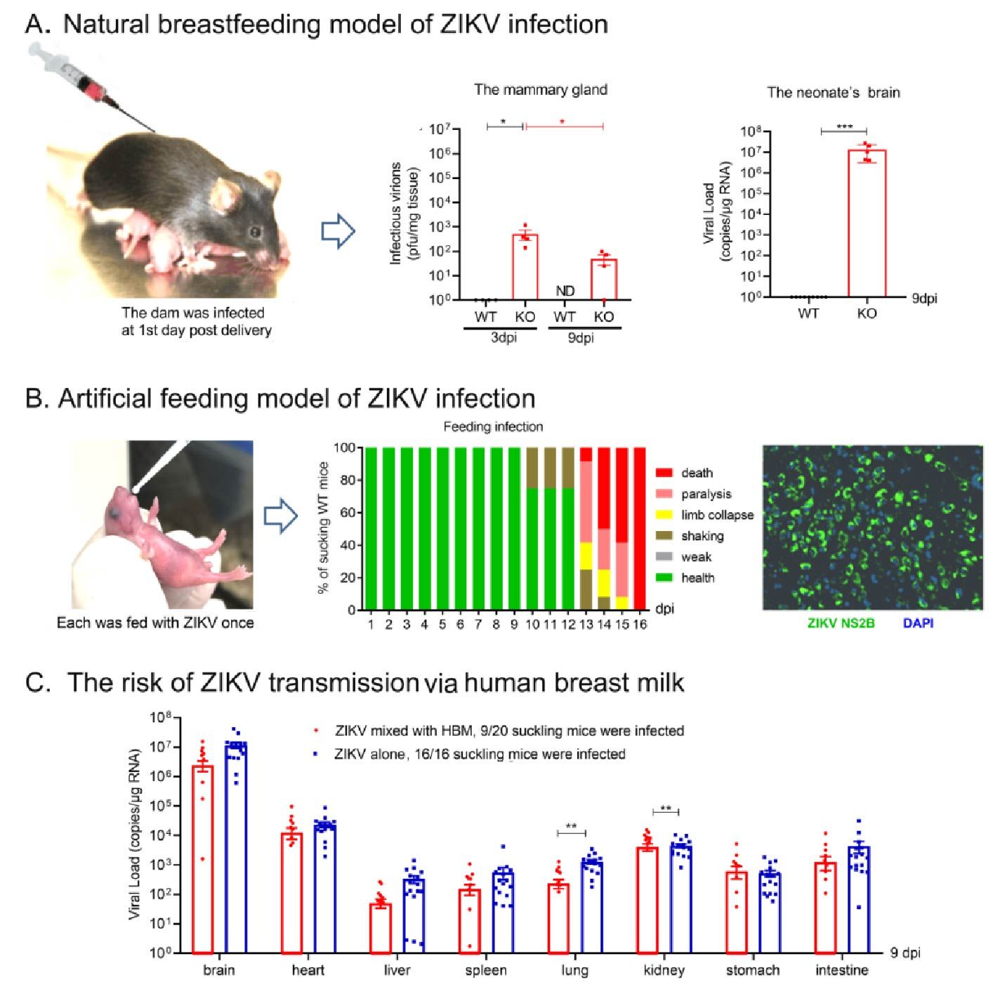 Zika virus is confirmed to be transmitted through breastfeeding through animal models