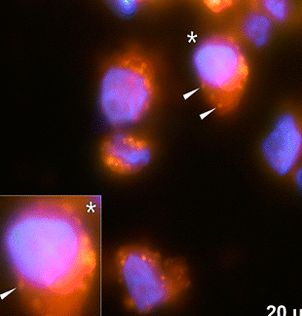 Animal experiment reveals the mechanism of aluminum in allergic immunity and systemic allergen immunotherapy