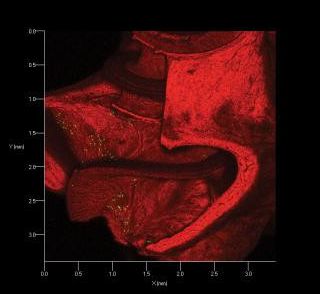 [Animal experiment]-Cochlear implant has been upgraded due to gene therapy