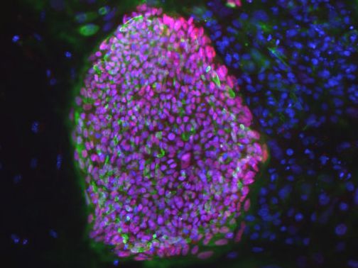 [Animal Experiment]-New Gospel for Diabetic Patients FGF1 protein can efficiently restore blood glucose levels in mice