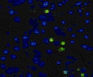 [Animal experiment]-Southern Medical University found that knockout of α-synuclein protects dopaminergic neurons in Parkinson\'s disease model rats