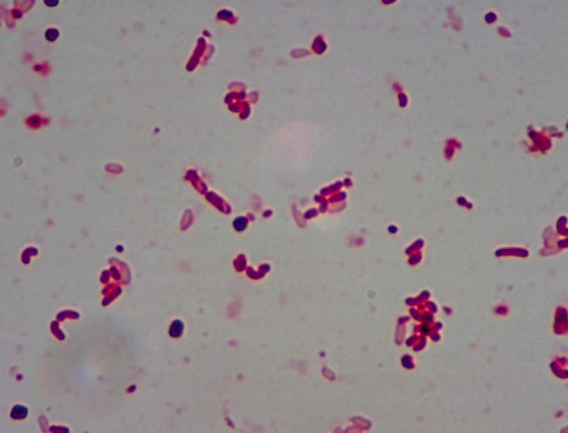 Confirmed that miRNA can inhibit the apoptosis of nerve cells induced by methylmalonic acid