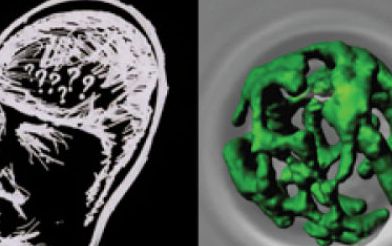 What is the mechanism of Alzheimer\\