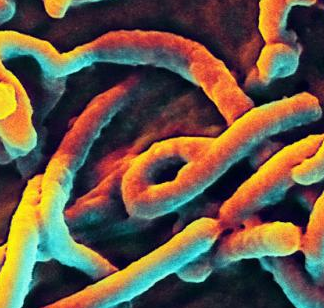 The key to avoiding a large Ebola outbreak is early screening