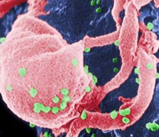 Cutting out the HIV virus gene can completely cure AIDS