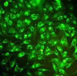 A fluorescent reagent can make cancer stem cells \"show up\"