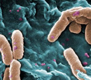 Drug-resistant bacteria may also be more pathogenic