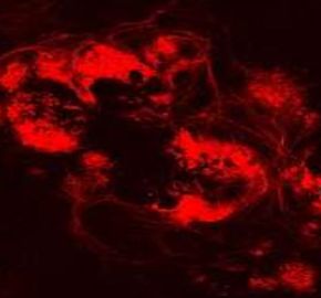 Optic nerve cells grown in the laboratory