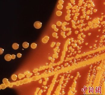 Chāojí xìjùn kě dǐkàng suǒyǒu yǐ zhī kàngshēngsù 14/5000 Super bacteria can resist all known antibiotics