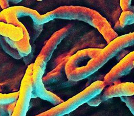 What is the mechanism of Ebola virus destroying the immune system?