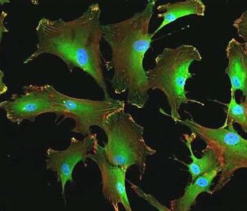 Pro-elastin may accelerate research on new stem cell therapy