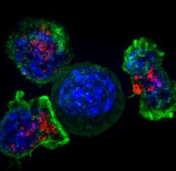 Expected to develop new therapies for drug-resistant cancer cells