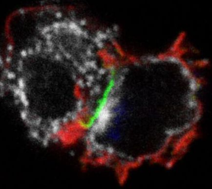 Two-in-one CAR-NK therapy, effective against a variety of cancers!