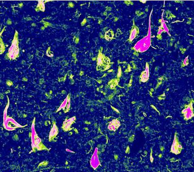 TRIM26 expression profile in human and mouse main tissues and organs