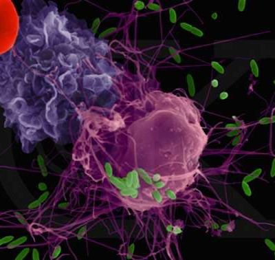 M1 natural virus is expected to kill cancer cells accurately