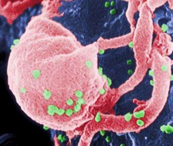 A radical cure for AIDS requires cutting off the HIV virus gene