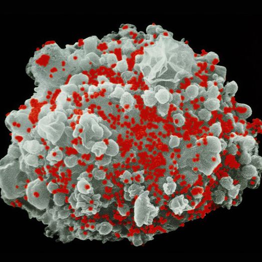 How does HIV kill most cells?