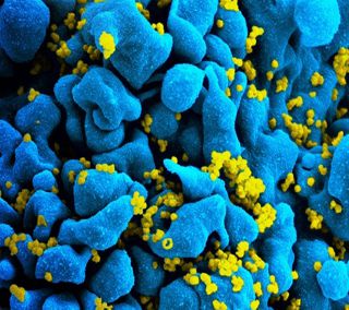 New high-efficiency antibodies appear in human AIDS