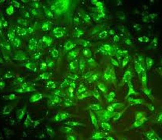 Fluorescent reagents can visualize cancer stem cells