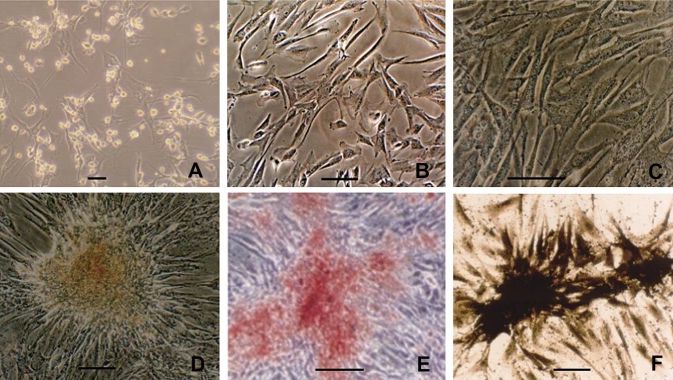 Rabbit model: Tissue engineering periosteum to repair irregular bone defects