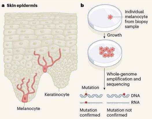 Measuring DNA mutations accumulated in individual skin cells predicts melanoma risk