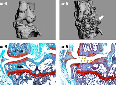 Omega 3 fatty acids reduce the severity of osteoarthritis in mice