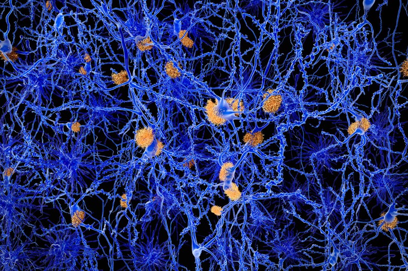 Alzheimer\'s disease drug causes brain cell damage in mice