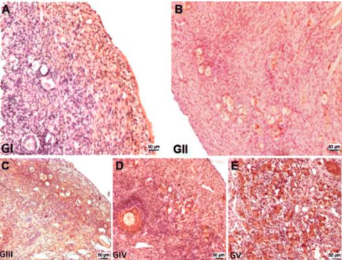 Miniature pig model: Heterotopic ovarian transplantation reduces cell apoptosis than orthotopic transplantation