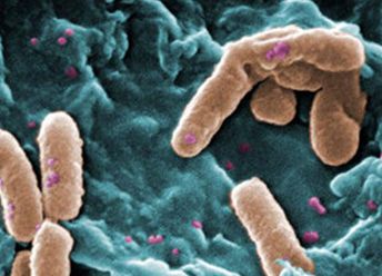 Drug-resistant bacteria may also be more pathogenic