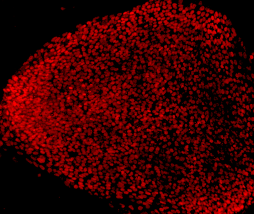 Edit stem cell therapy may treat blindness