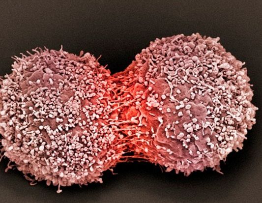 Research claims to find the Achilles heel of cancer and kill every cancer cell