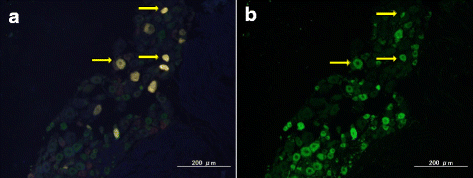 【Animal Modeling】-The role of nerve growth factor antibody in mouse knee osteoarthritis pain model