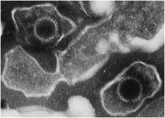 【Animal modeling】-Preclinical animal experiments show that exosomes derived from Vδ2-T cells can effectively control EBV-related tumors and induce T cell anti-tumor immune responses