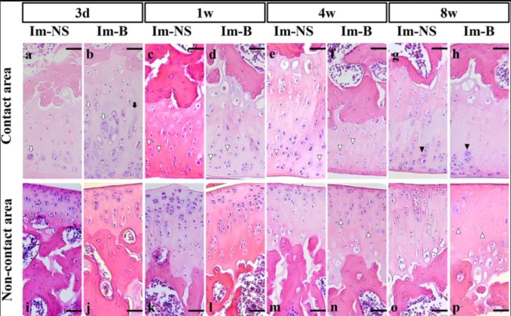 Fixed knee joint model in rats: joint bleeding accelerates cartilage degeneration