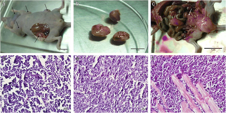 【Animal Modeling】-Establishment and identification of human gastric cancer metastasis model in nude mice