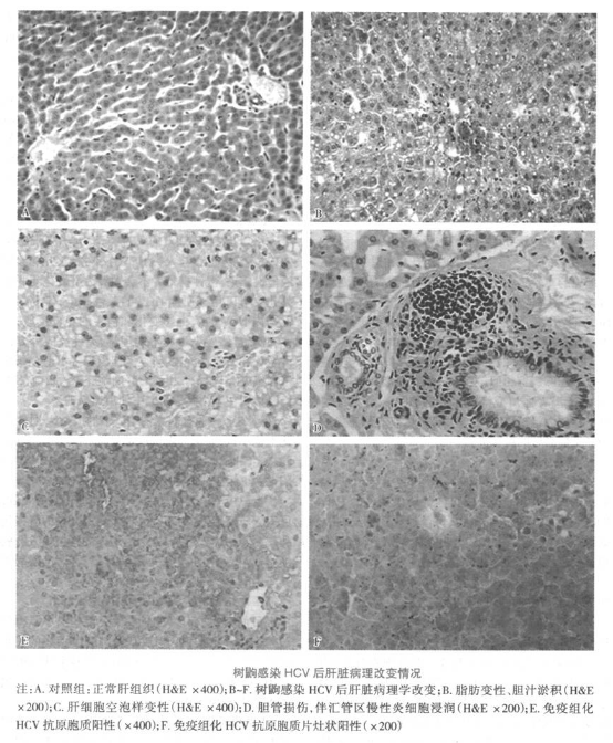 【Disease animal model】-Hepatitis C transgenic mouse model