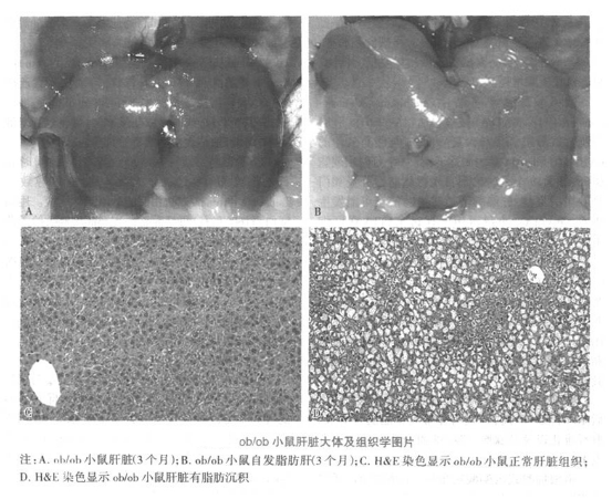 [Disease animal model]-Nutritional fatty liver model