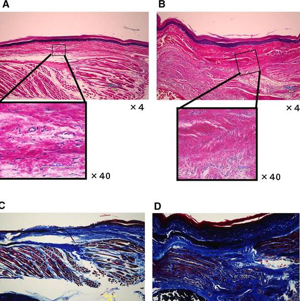 【Animal Modeling】-Animal Model of Chronic Pain Scar