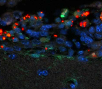 【Animal Modeling】-Salmonella Meningitis Model