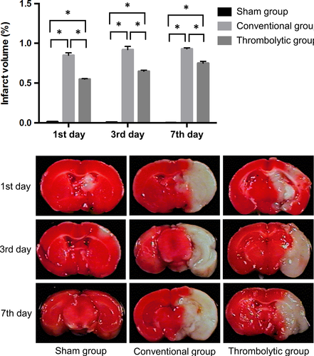 [Animal modeling] The effect of thrombolysis within 6 hours on acute cerebral infarction in a rat model of ischemic stroke with middle cerebral artery embolism