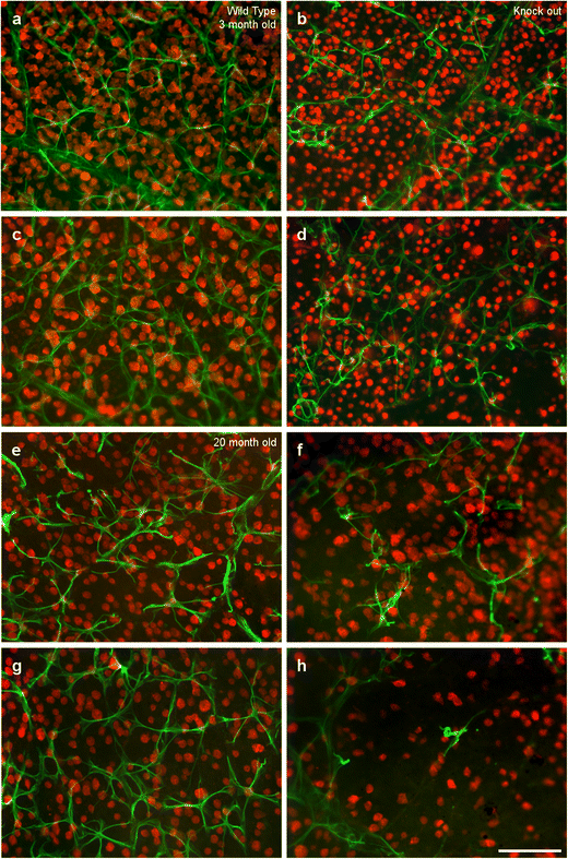 What is the retinal aging model in mice caused by osteopontin deficiency? -【Animal Modeling】