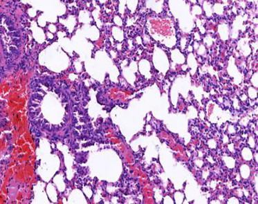 【Animal Modeling】-What are the effects of Schisandra syrup on bronchial asthma in mice?