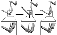 【Animal Modeling】-Why build animal models of post-traumatic osteoarthritis?