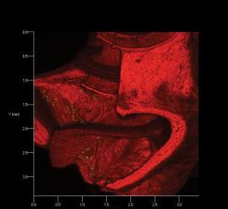 [Animal Modeling]-Gene therapy can be used for cochlear implantation