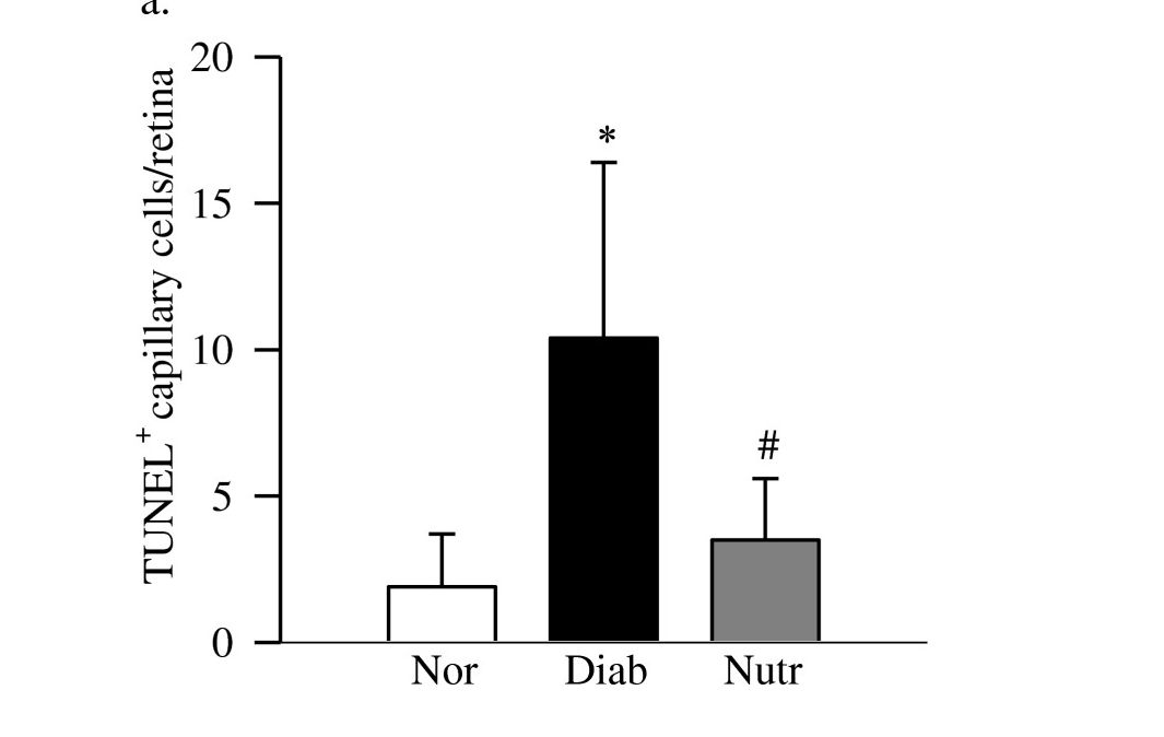 【Animal Modeling】-Therapeutic effect of nutritional supplements on retinopathy of diabetic rats