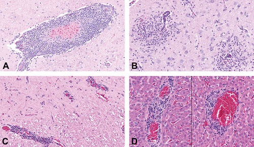 【Animal Modeling】-Naphthoquine induces central nervous system and hepatic vascular center toxicity in Beagle dogs