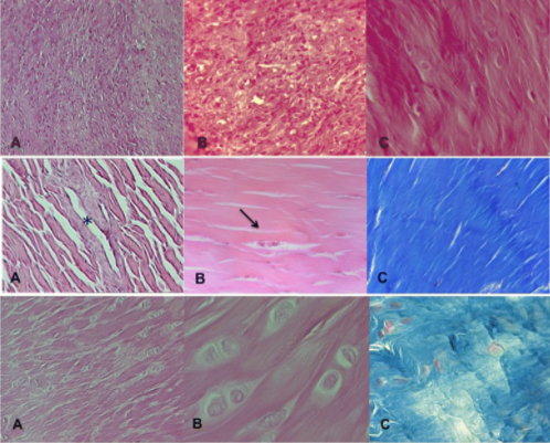 【Animal Modeling】-Histological changes of semitendinosus after anterior cruciate ligament reconstruction in young rabbits