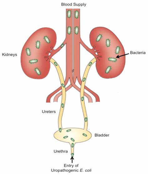 Urinary system disease